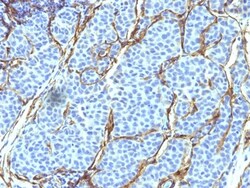 NGFR/TNFRSF16/p75NTR Antibody (SPM299), Novus Biologicals 0.2mg; Unlabeled:Antibodies,